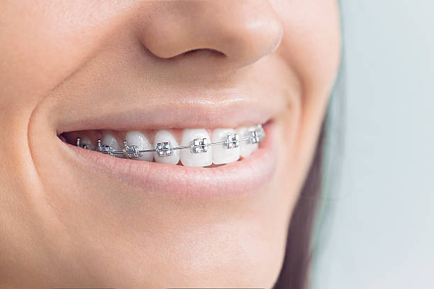 Why Choose Us for Your Dental Needs in Lakeland, MN